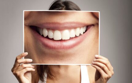 Gülüş Tasarımı ile İdeal Bir Gülümseme