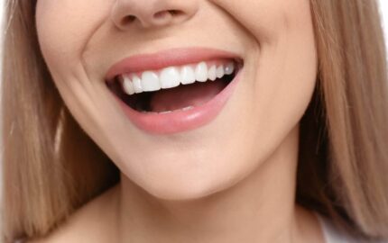 Gülüş Tasarımı Nasıl Planlanır?